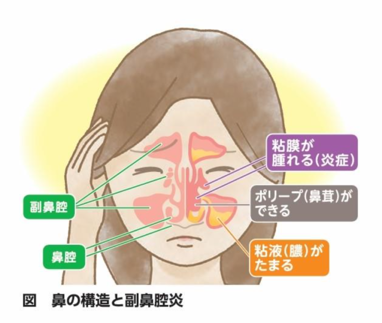 副鼻腔の解剖図（目・脳との位置関係）